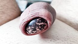 My foreskin play - bean